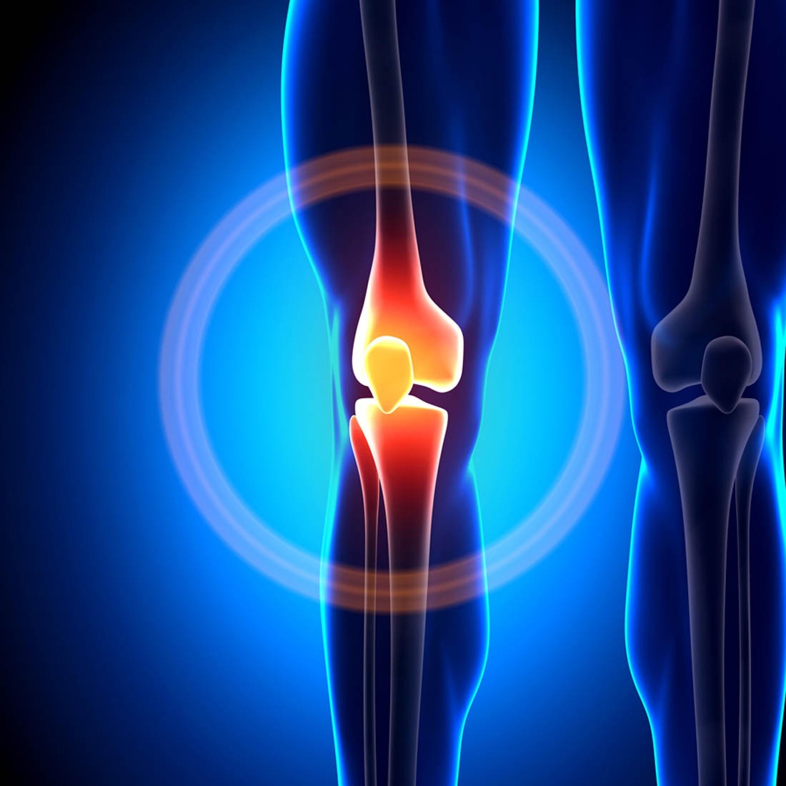 Knee Pain Treatment and Physiotherapy in Lahore – NBR Clinic
