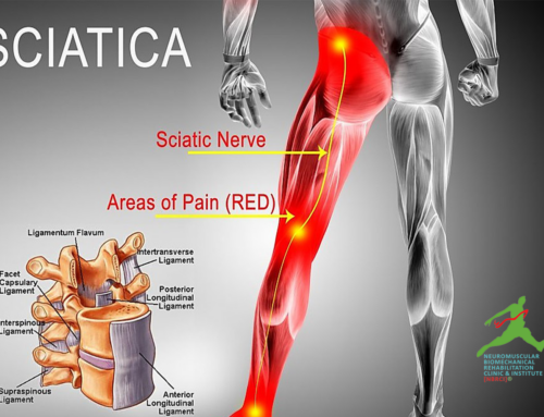 Sciatica Physical Therapy Treatment in Lahore by NBR Clinic