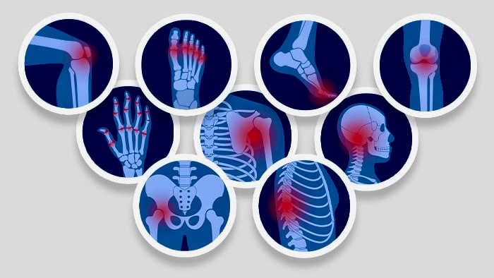 chronic pain management in Lahore