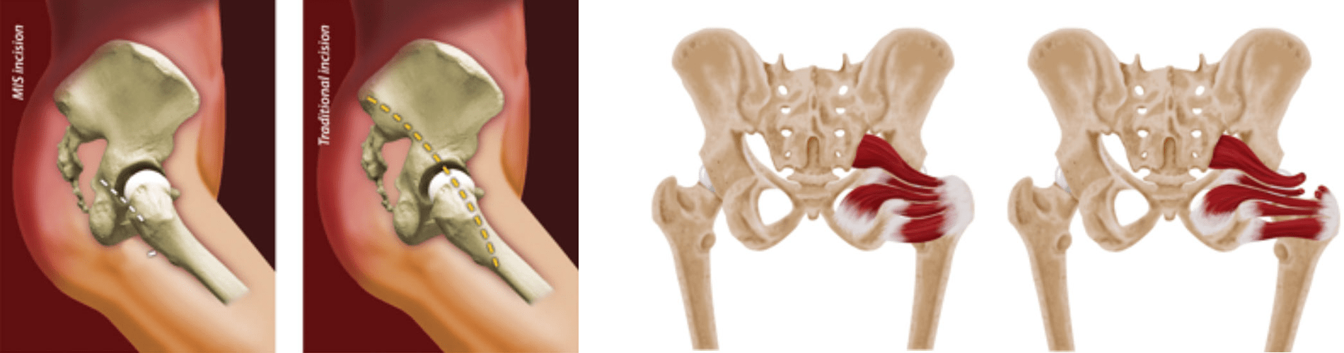 Illustration of minimally invasive joint procedures showing arthroscopic surgery and advanced medical tools used for joint repair.
