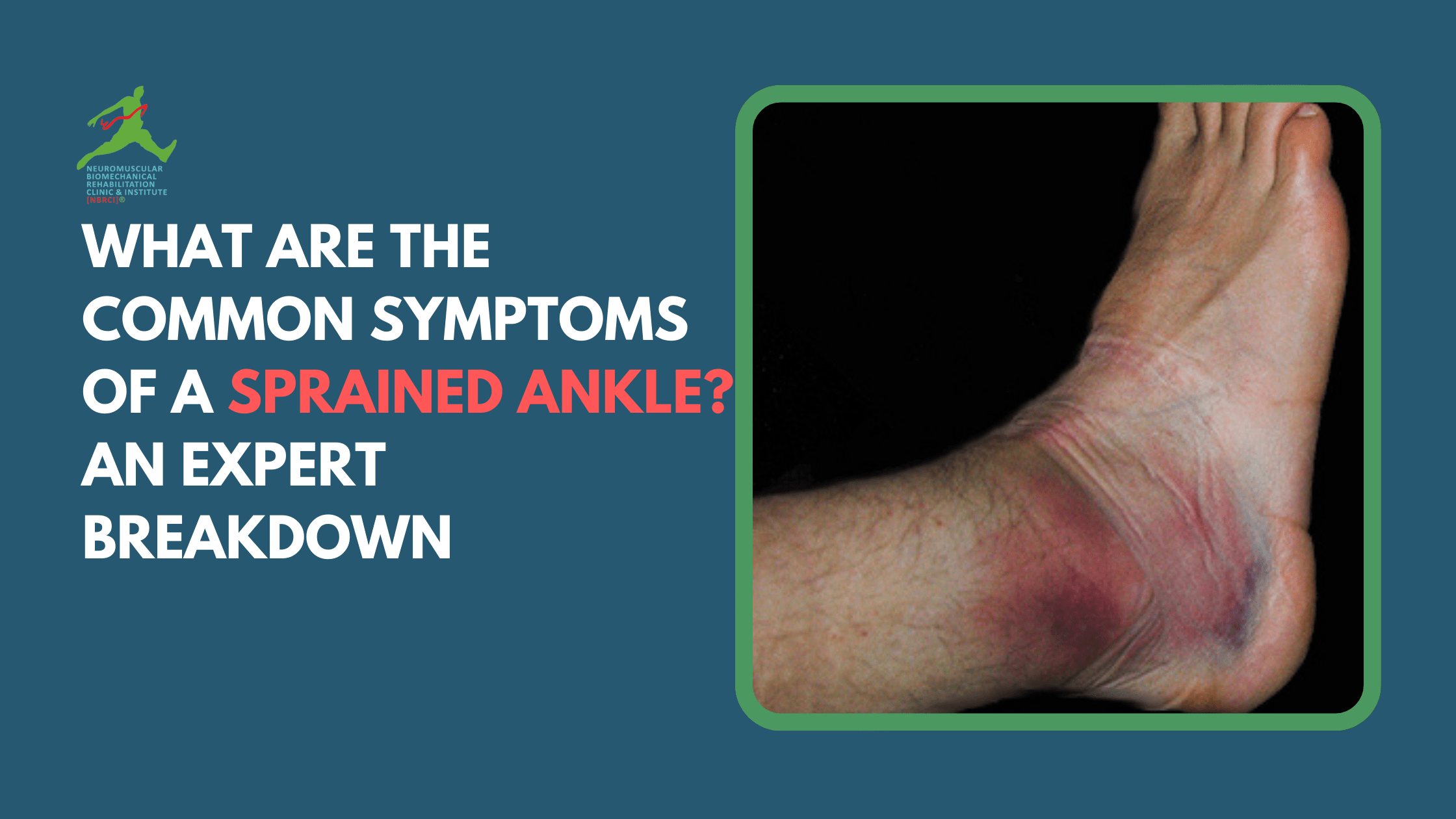 What Are the Common Symptoms of a Sprained Ankle?
