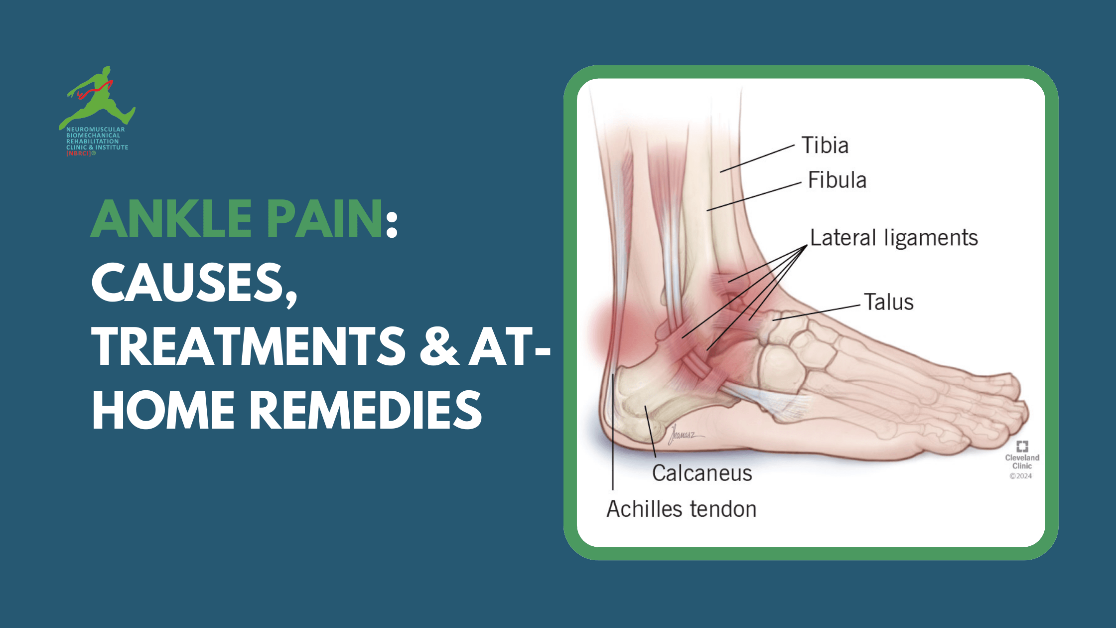 Ankle Pain: Causes, Treatments & At-Home Remedies