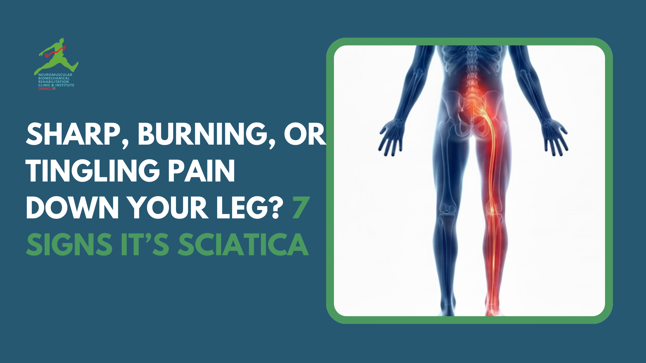 Is That Sharp, Burning, or Tingling Pain Down Your Leg? 7 Signs